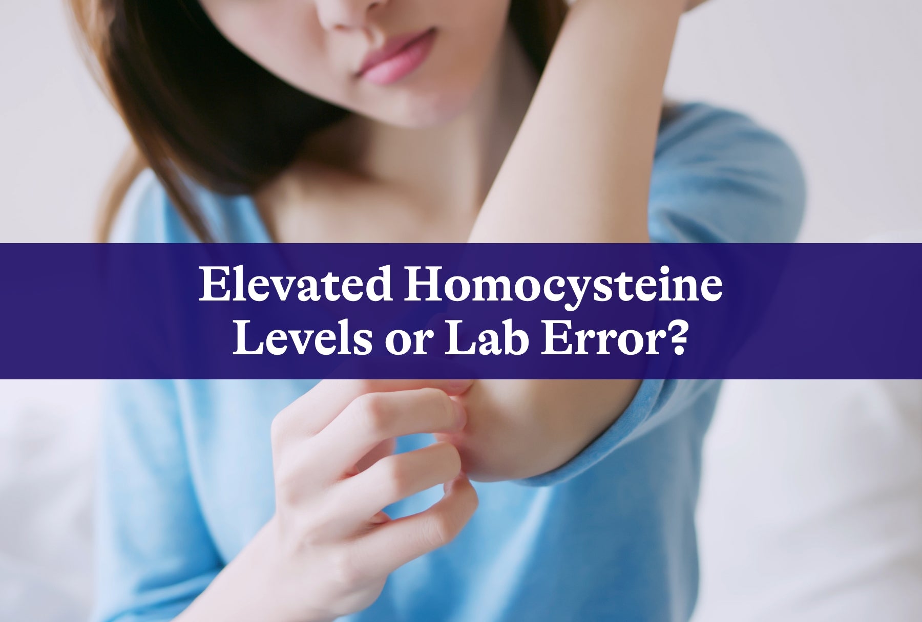 Elevated Homocysteine Levels or Lab Error?