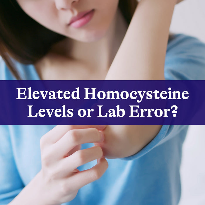 Elevated Homocysteine Levels or Lab Error?